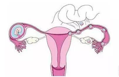 咸阳女性患子宫内膜异位影响怀孕