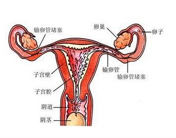 咸阳妇女卵巢囊肿7厘米应该怎么办